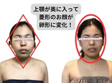 チチ(Chichi)/No.2のお客様の前からの変化