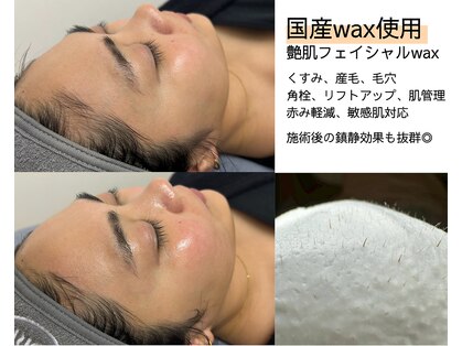 ラディス(Ladis)の写真