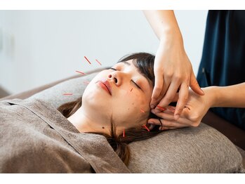 からだ鍼灸院の写真/【筋膜×筋肉への美容鍼】表情筋×表情筋膜×頭皮のトリプルケア!自己治癒力で根本的な悩み解消!