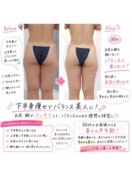 アンジェ あゆむ鍼灸院/人気NO.1 Ange式メディセル施術