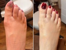 フス(FUSS)/foot&bodycare FUSS