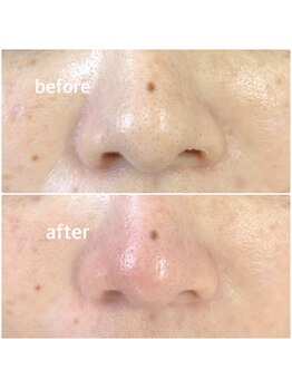 メイクマジック(Makemagic)/お鼻の毛穴こんなにきれいに