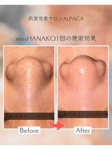 アルパカ(ALPACA)/missHANAKO