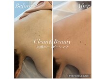 クリーンアンドビューティ 札幌(Clean&Beauty)/結婚式へ♪背中の準備も今から！
