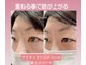 プリティアイ(pretty eye)の写真