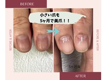 ブルームブルーム(BLOOMブルーム)/小さい爪も縦長美爪に！！