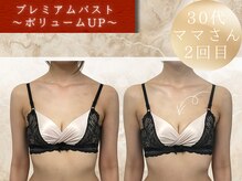 ヴェルナ(VELUNA)