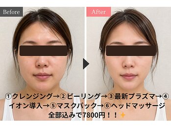 ルカクリニカル(Luka.CLINICAL)の写真/《5月OPEN》結果重視★夜もエステ◎元美容看護師が導く確かな技術で実感を◎痛みダウンタイムも最小限に！