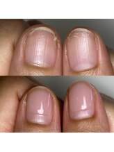 フェミニンネイル(Feminine Nail)/