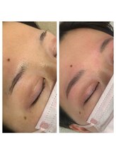 ラ フルール(La Fleur)/ハリウッドブロウリフト