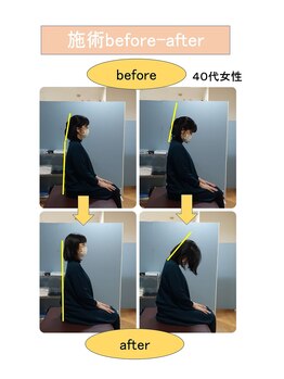 いみすぽ整体/40代女性ビフォアアフター