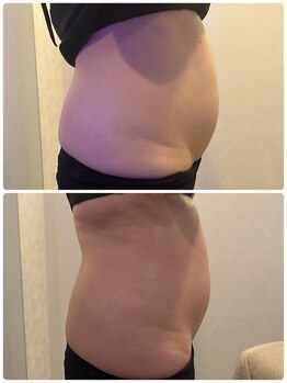 エステティックジュネス(JEUNESSE)/シークレットボディ