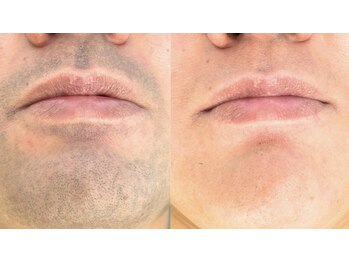 ラクーン(RACCOON)/