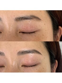 アイアム 大阪梅田 中崎町店(I am.)/HBL(ハリウッドブロウリフト)