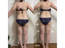 ヨサパーク リアン(YOSA PARK Lien)/モニター様before→after/痩身