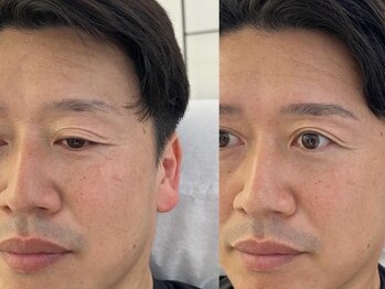 ハリウッドブロウリフト ワクシー 自由が丘店(HOLLYWOOD BROW LIFT WAXYYY.)の写真/¥5500/メンズこそ眉毛で清潔感UP!有名人来店眉毛サロン!毛穴黒ずみフェイシャルWAX◎自由が丘アイブロウ