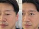 ハリウッドブロウリフト ワクシー 自由が丘店(HOLLYWOOD BROW LIFT WAXYYY.)の写真/¥5500/メンズこそ眉毛で清潔感UP!有名人来店眉毛サロン!毛穴黒ずみフェイシャルWAX◎自由が丘アイブロウ