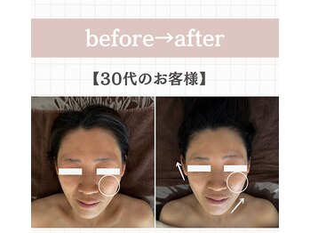 ジェイド(Jade)/初回のbefore→after