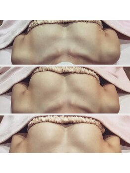 プレミアムボディバランス 大宮(Premium Body Balance)の写真/【サイズダウンとバストアップを同時に叶える★】大きさ・垂れ・左右差などバストのお悩みご相談ください☆