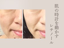 ラウン 京都(ROUN')/5年前のハリと透明感が復活。