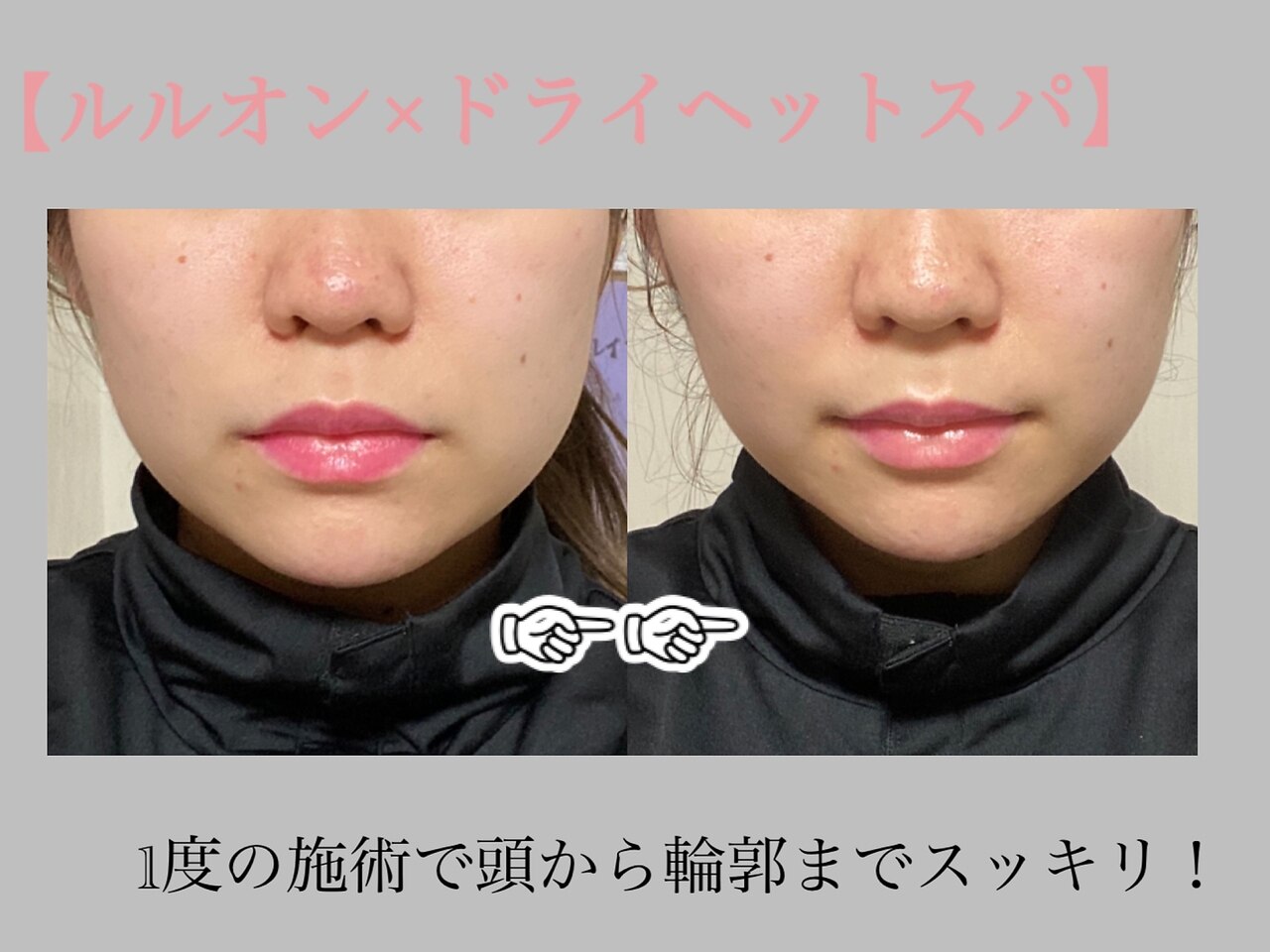 ヨサパーク ケー(YOSA PARK K)｜ホットペッパービューティー