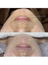 コモレビ(komorebi)/