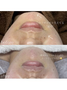 コモレビ(komorebi)/