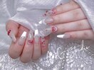 チップ長さだしさくらんぼネイル