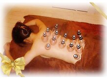 癒しの空間もみの木 錦糸町店/吸玉カッピング(蒸しタオル付き)