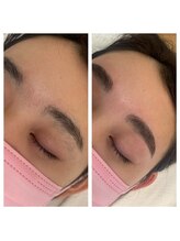 ラ フルール(La Fleur)/ハリウッドブロウリフト