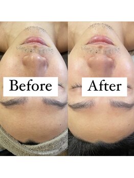 サマラボ 笹塚店(Sama Labo)/メンズフェイシャル