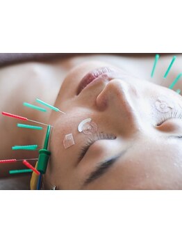 鍼灸施術を受けたい