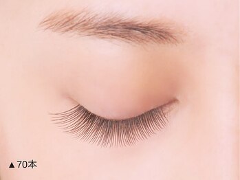 グランアイ 八千代緑が丘店(GRAN EYE)/装着両目140本イメージ