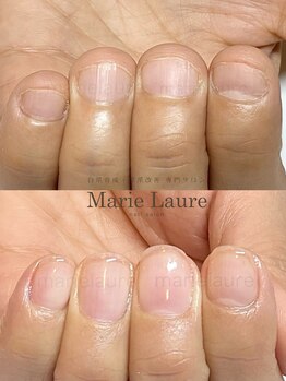マリーロール 梅田店(Marie Laure)/深爪改善/自爪育成/ネイルケア