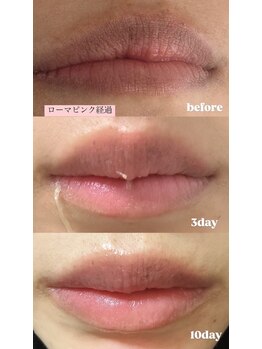 キュライム カブール町田店/ローマピンク導入してます