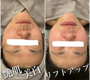 ヴィアージュ(Viage)