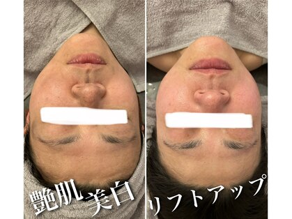 ヴィアージュ(Viage)の写真