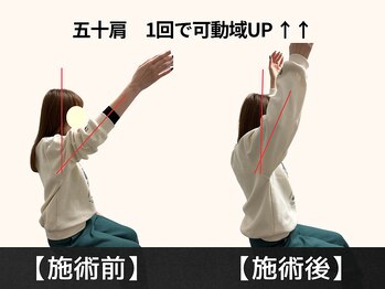 パルマ なかもず(Palma)/固まってしまった肩を救う整体