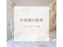 ナオフクオカ ヒーリングフォースエヌ(NaoFukuoka/healingforceN)/ビフォーアフター集