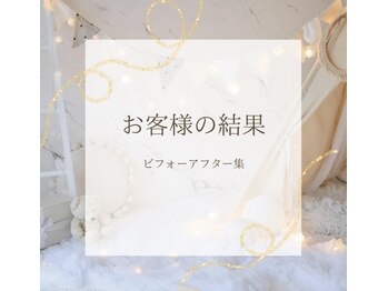 ナオフクオカ ヒーリングフォースエヌ(NaoFukuoka/healingforceN)/ビフォーアフター集