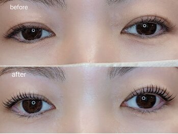 アイラブ(eye love)/