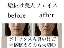 アールイー(Re:)の雰囲気（眠ってしまう程の力加減でお顔が整うと話題の小顔矯正◎）