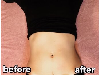 ザ ボディメイク(THE BODY MAKE)/【痩身】お腹+美尻+小顔+バスト