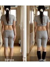 マイルーム(My room..)/骨盤＋全身ケア　1回　施術前後