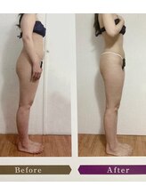 プアマヌ(PUA MANU)/痩身、コリや浮腫解消♪