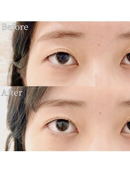 ピレンジ(Prange)/皮膚かぶりがある方も大丈夫!