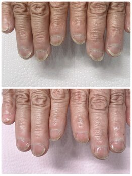 トーン(TONE)/すっきり綺麗に!ネイルケア