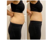 リアライン ラボの雰囲気(産後3ヶ月から5ヶ月にかけて3回のファシアケア前後 産前産後)