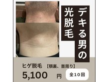 ネクスト 伊勢店(NEXT)/顎裏脱毛