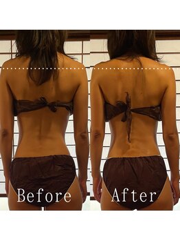 ボッカ(bocca)/筋膜リリースBefore After